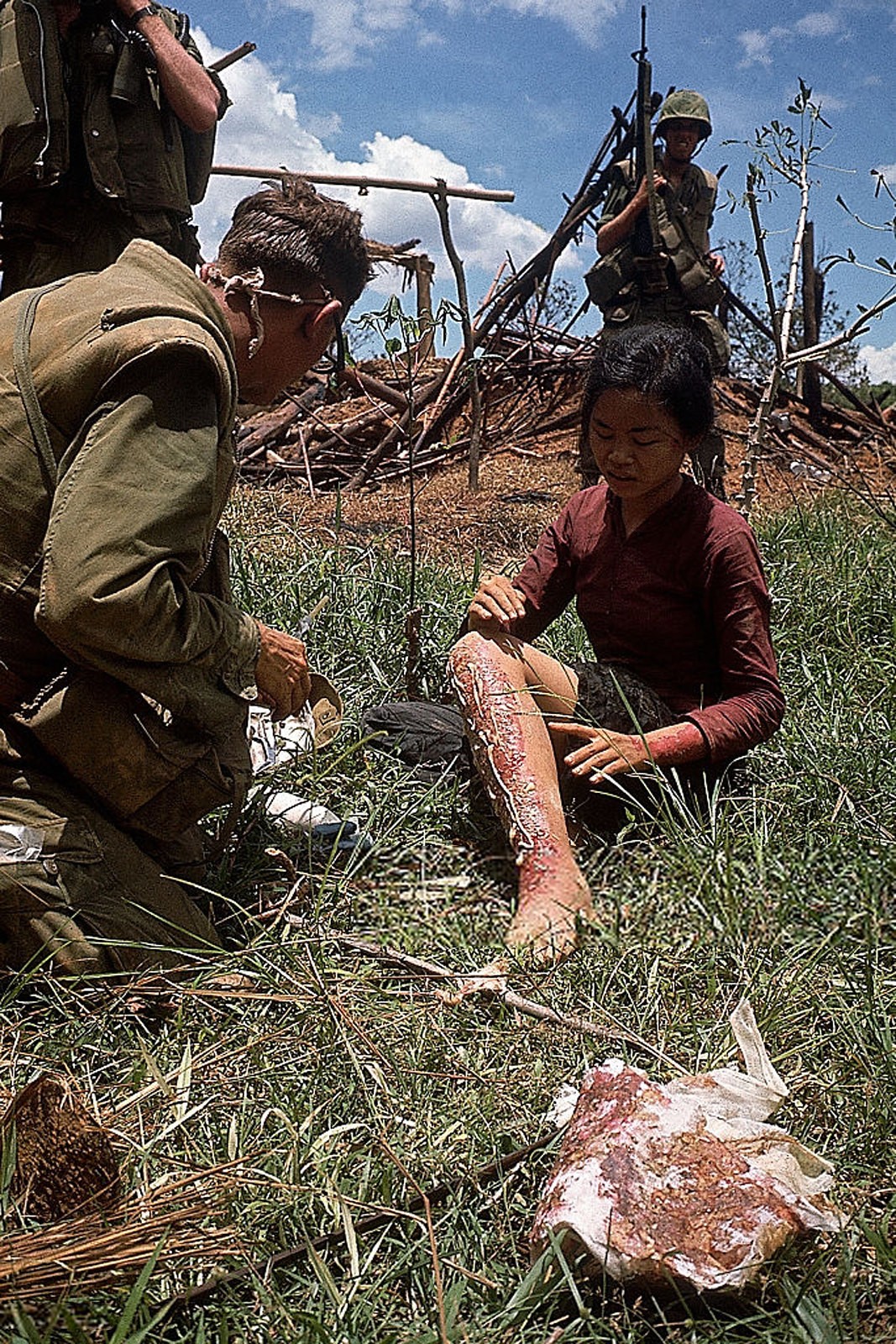 Vietnam War 1967 - US Marine Treating a Vietnamese Girl