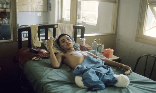 Vietnam War 1972 - Thương binh tại Tổng Y Viện Cộng Hòa, Saigon